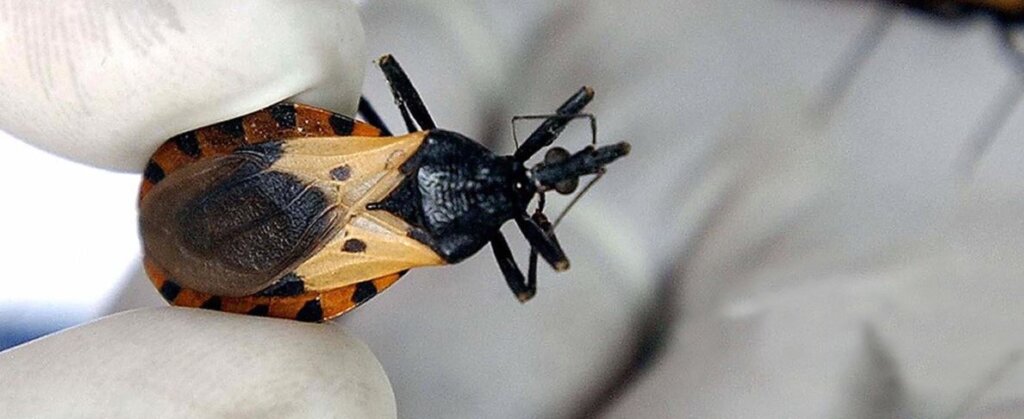 Chagas Disease